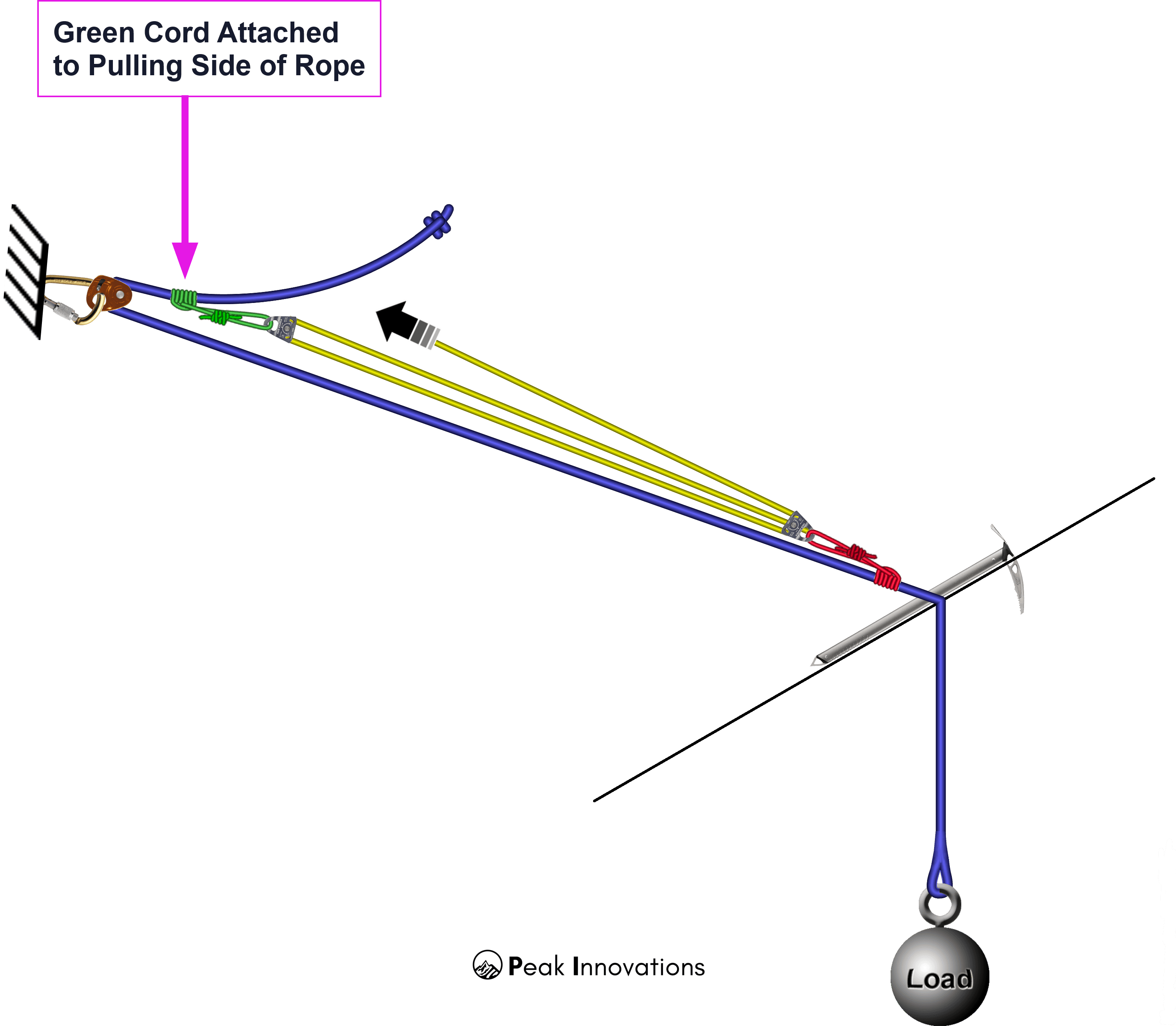 5:1 mechanical advantage — Complex haul